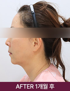 after 이미지