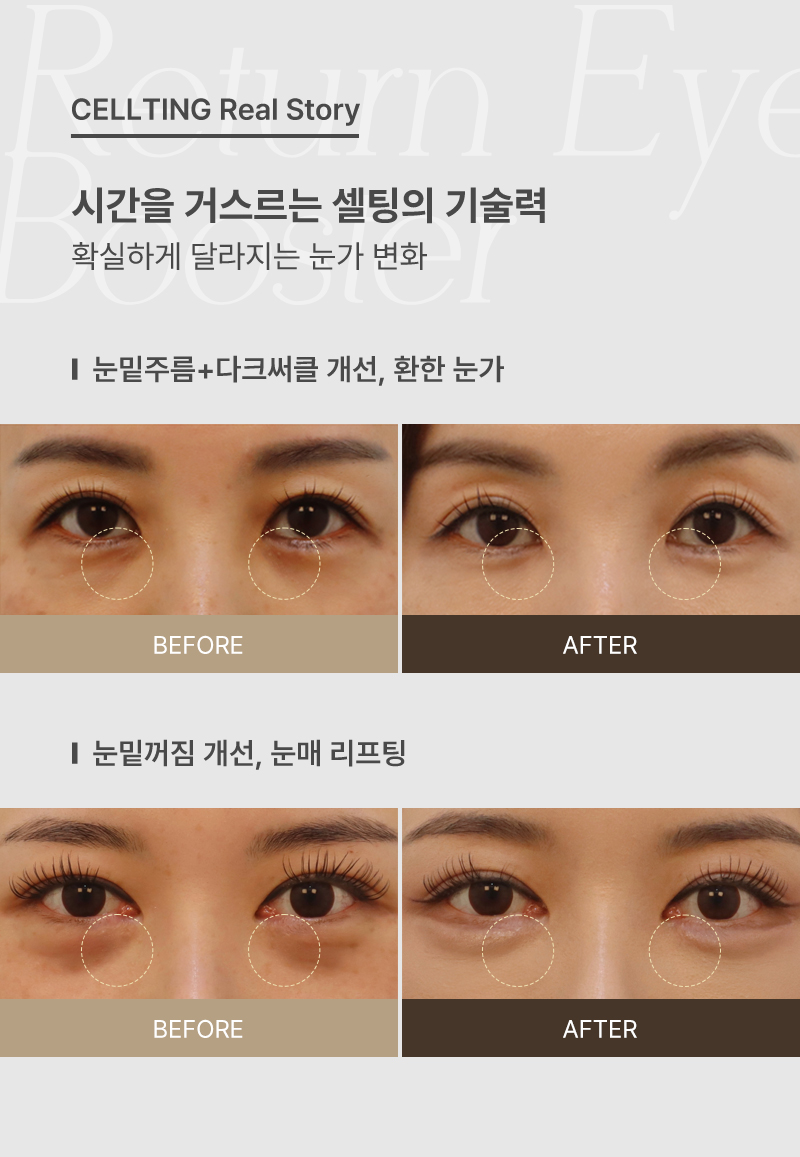 통증은 DOWN! 탄력은 ON! 한가위 ONDA