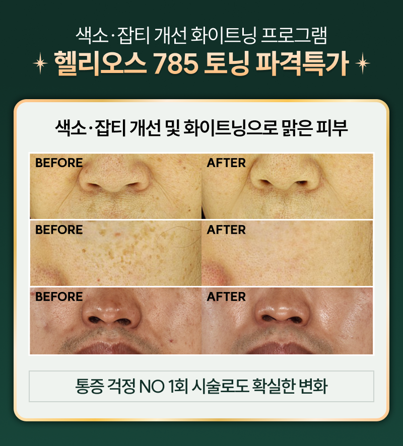 Only 셀팅! 프리미엄 시술 최대 할인 셀팅No.1 시그니처 시술 49%