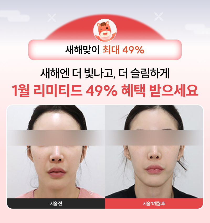 새해엔 더 빛나고, 더 슬림하게 1월 리미티드 49% 혜택 받으세요