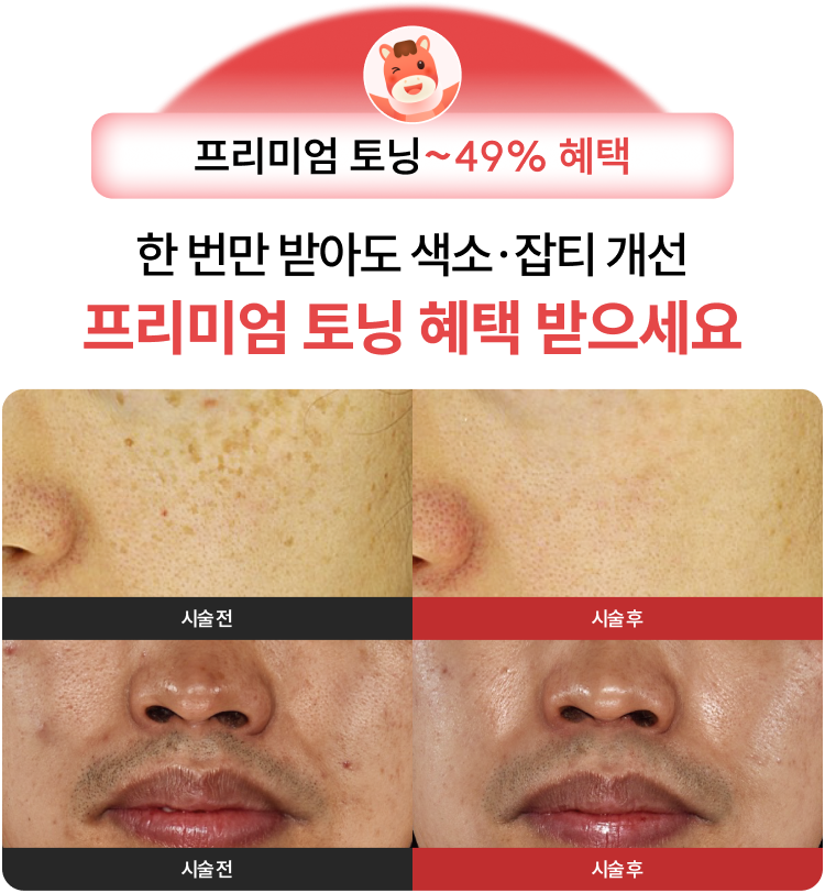 한 번만 받아도 색소·잡티 개선 프리미엄 토닝 혜택 받으세요