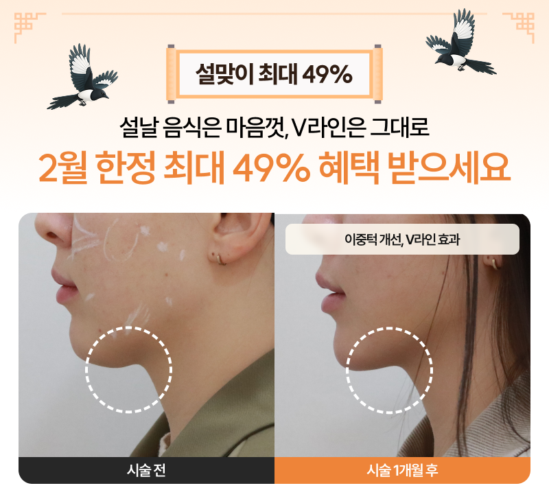 새해엔 더 빛나고, 더 슬림하게 1월 리미티드 49% 혜택 받으세요