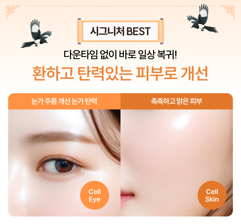 셀팅 포니라운드 기법으로 중하안면부 집중 리프팅