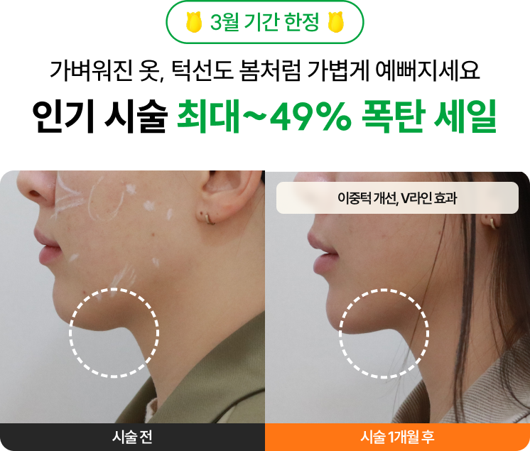 3월 기간 한정 가벼워진 옷, 턱선도 봄처럼 가볍게 예뻐지세요 인기 시술 최대~49% 폭탄 세일