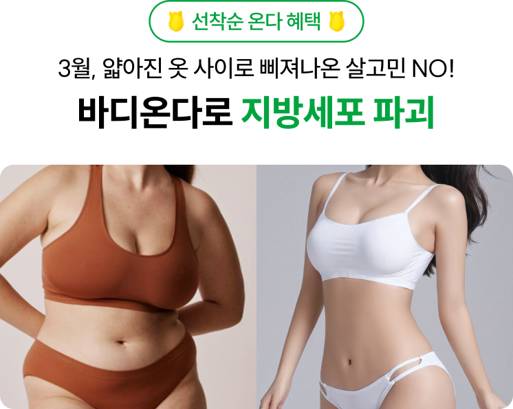 선착순 온다 혜택 3월, 얇아진 옷 사이로 삐져나온 살고민 NO! 바디온다로 지방세포 파괴